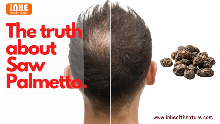 Saw Palmetto for Hair Growth Saw Palmetto for Hair Growth